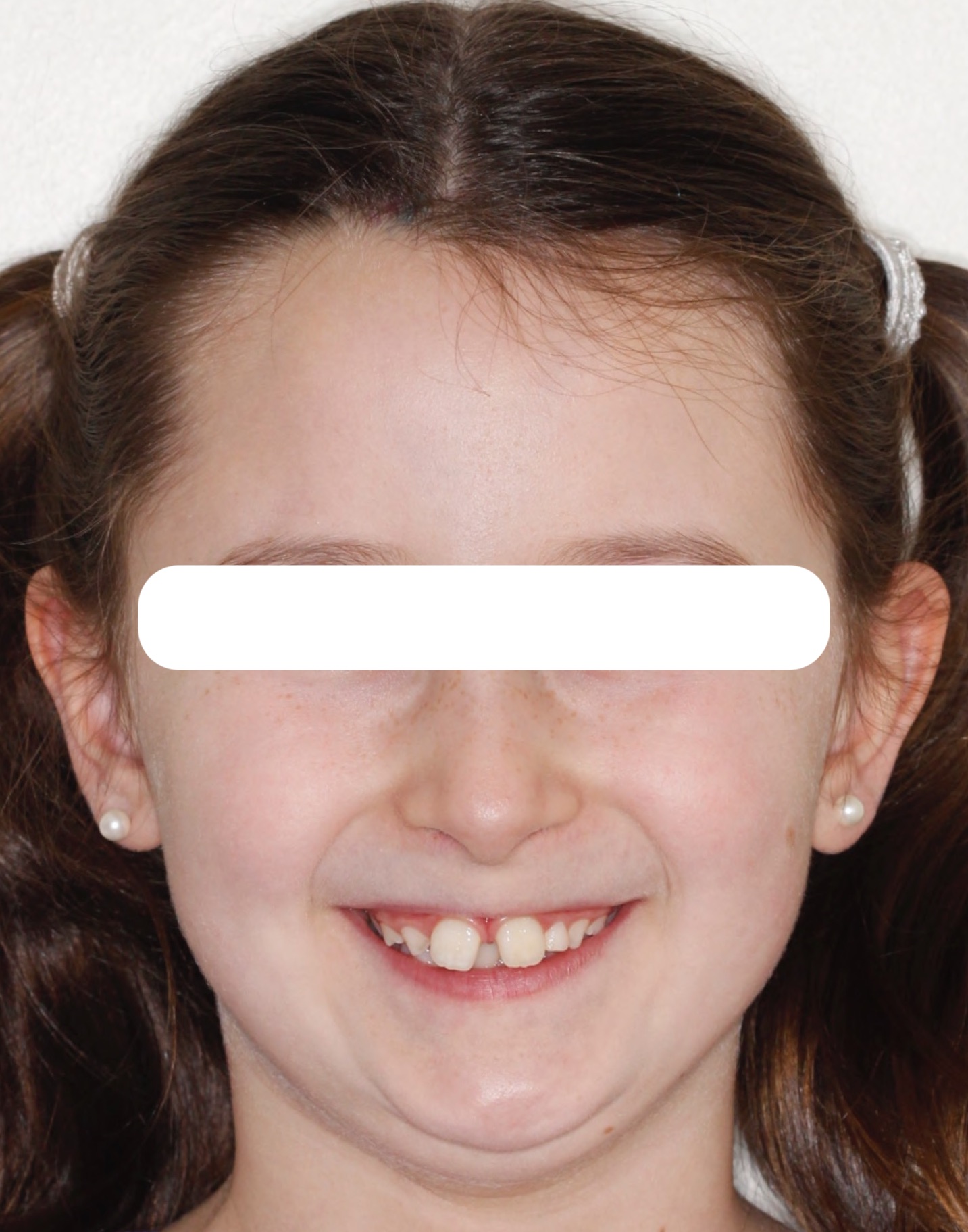 smile6